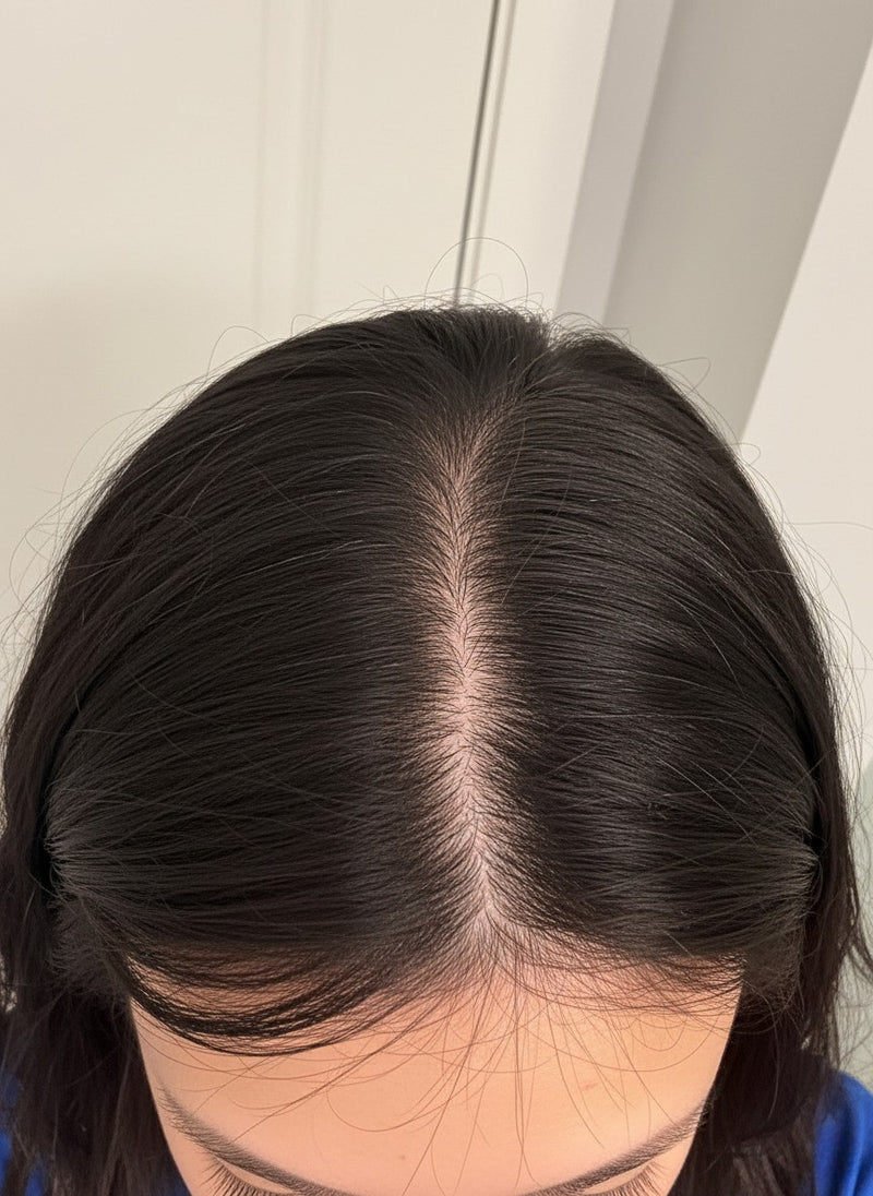 After 12 weeks - improved density