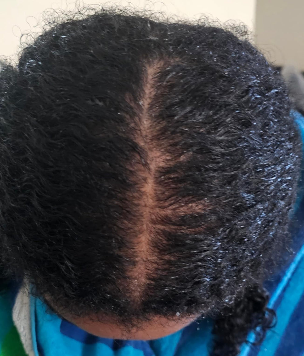 After 12 weeks - visible baby hairs