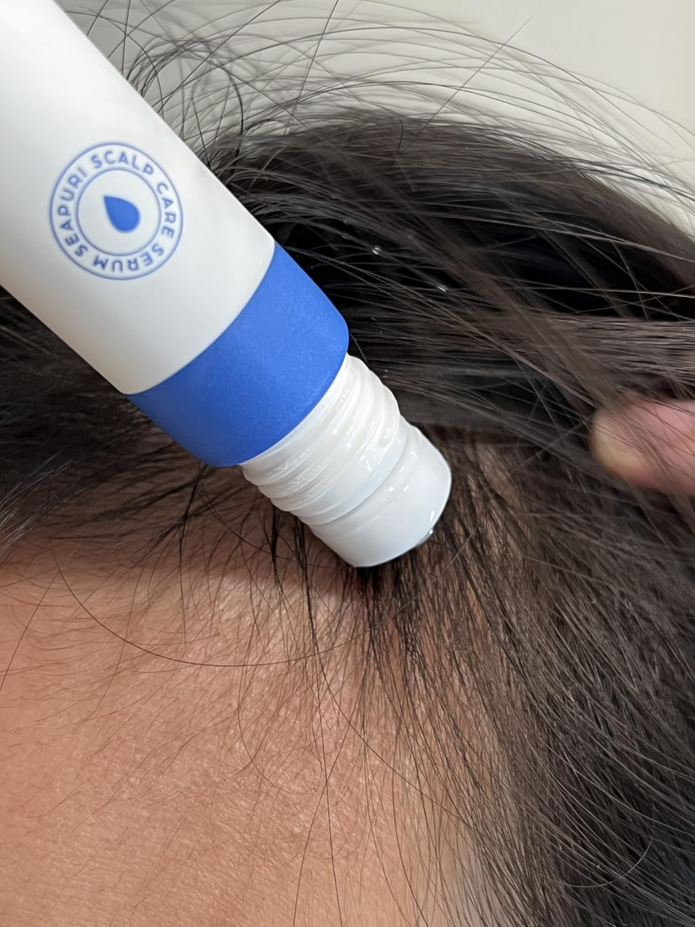 Before treatment - visible scalp